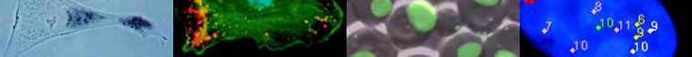 Images of RNA in Single Cells
