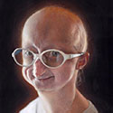 Meghan, Hutchinson-Gilford Progeria Syndrome
