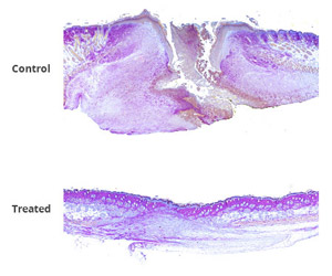 Mouse skin was burned and treated with either a standard burn treatment or new wound-healing therapy. After two weeks, cross sections of burned skin show control skin (top image) had clearly not healed, with no hair follicles, sebaceous glands or other higher order structures present in the burn area. Burns treated with therapeutic gel (bottom image) showed progressive healing and tissue regeneration, including new hair follicles.