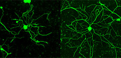 Images of regrowing neurons from adult mouse spinal cords. The right image shows a neuron in which fidgetin-like 2 has been depleted, causing the neuron to regenerate as shown by its increased number of branches.
