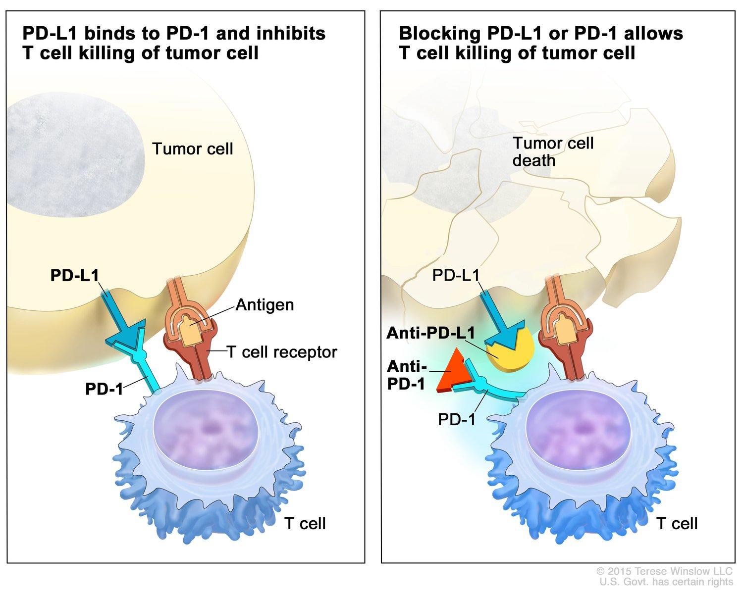 At left: A T cell has recognized a tumor cell as foreign (T cell receptor has bound to tumor cell antigen) but fails to attack because checkpoint proteins have interacted: The tumor’s PD-L1 protein has bound to the T cell’s PD-1 protein, putting the brakes on T cell activity. At right: In immunotherapy, monoclonal antibodies block checkpoint protein interactions so that T cells remain active to kill tumor cells. Here, one type of monoclonal antibody (Anti-PD-L1) has been designed to bind to the tumor’s PD-L1 protein, and another type (Anti-PD-1) works by binding to the T cell’s PD-1 protein.