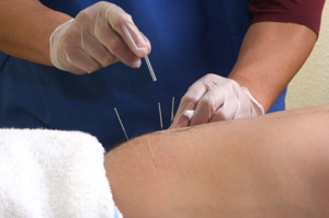 Students learn about complementary medical practices, such as acupuncture