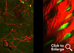 Imaging of burns indicates that those treated with the FL2 inhibitor nanotechnology experienced collagen deposition and hair follicle formation. (2-photo confocal microscopy) Credit: Vera DesMarais/Albert Einstein College of Medicine