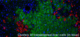 Liver-Cell Transplants Show Promise in Reversing Genetic Disease Affecting Liver and Lungs