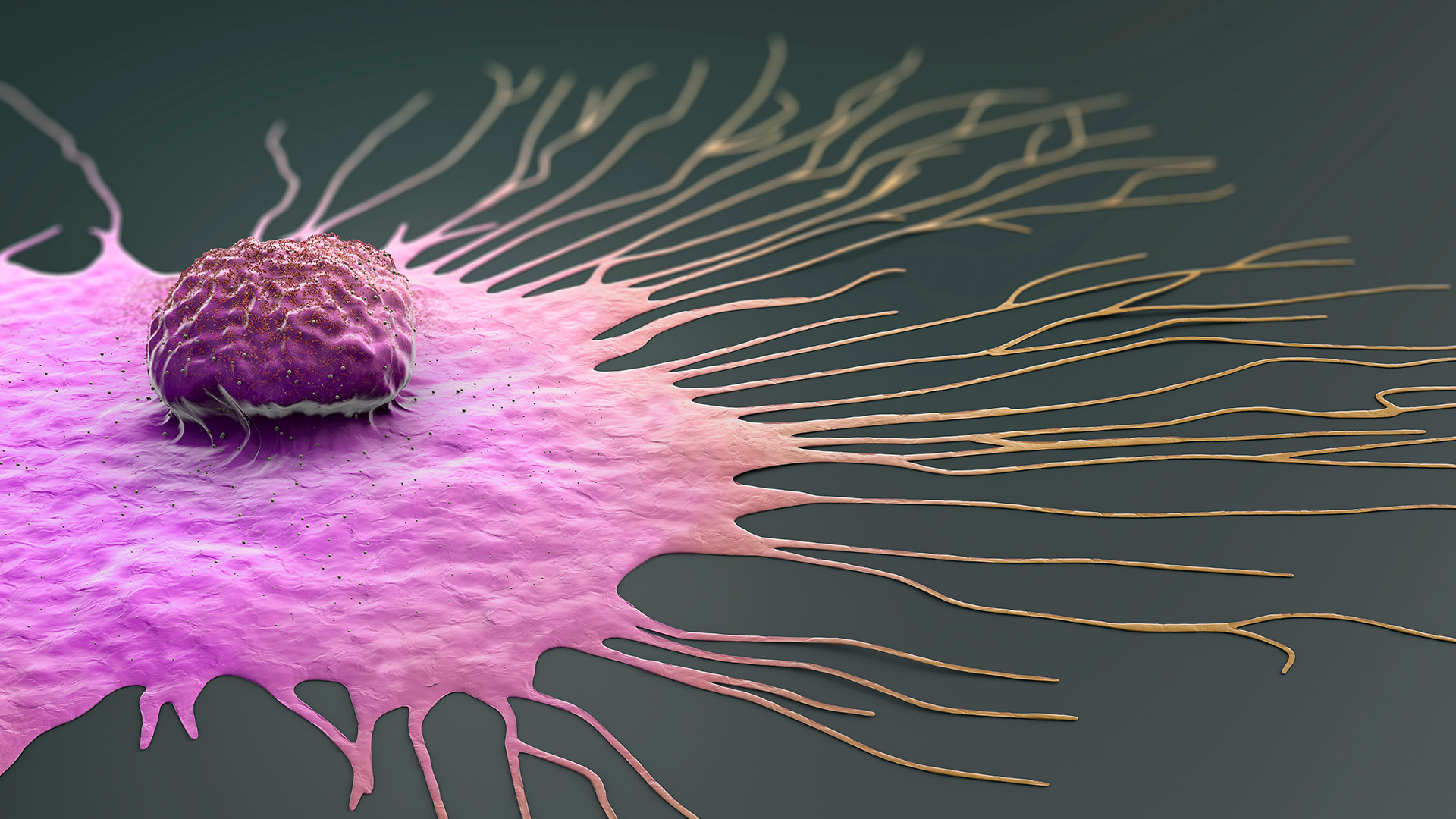 Montefiore Einstein Cancer Center Receives $10 Million Grant to Study Lung Metastasis in Breast Cancer