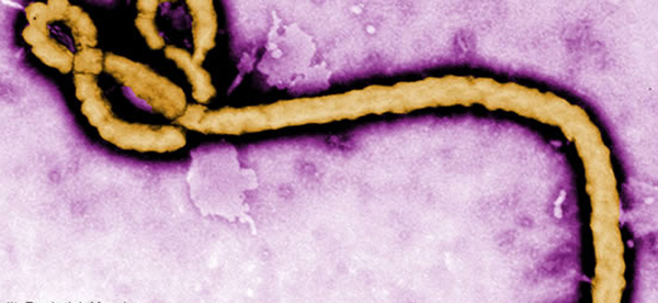 Study Identifies Ebola Virus's Achilles' Heel