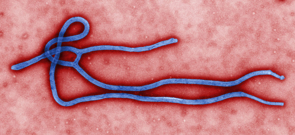 Researchers Discover First Human Antibodies That Work Against All Ebolaviruses