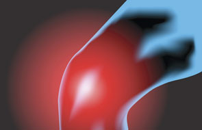 New Form of Relief for Osteoarthritis