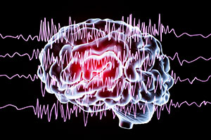 Severing the Brain Injury-Epilepsy Link