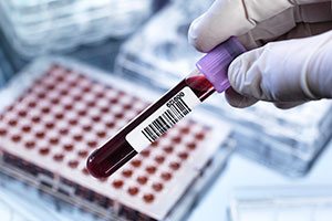 Mutated Splicing Factors in Blood Disease