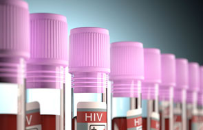 New HIV Treatment Strategy