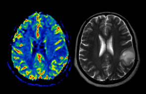 Better Brain Imaging