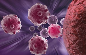 Improving Ability to Diagnose Blood Cancers
