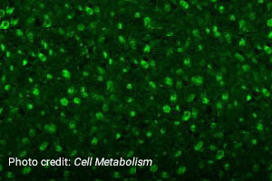 Autophagy Governs Circadian Clock and Blood Glucose Levels