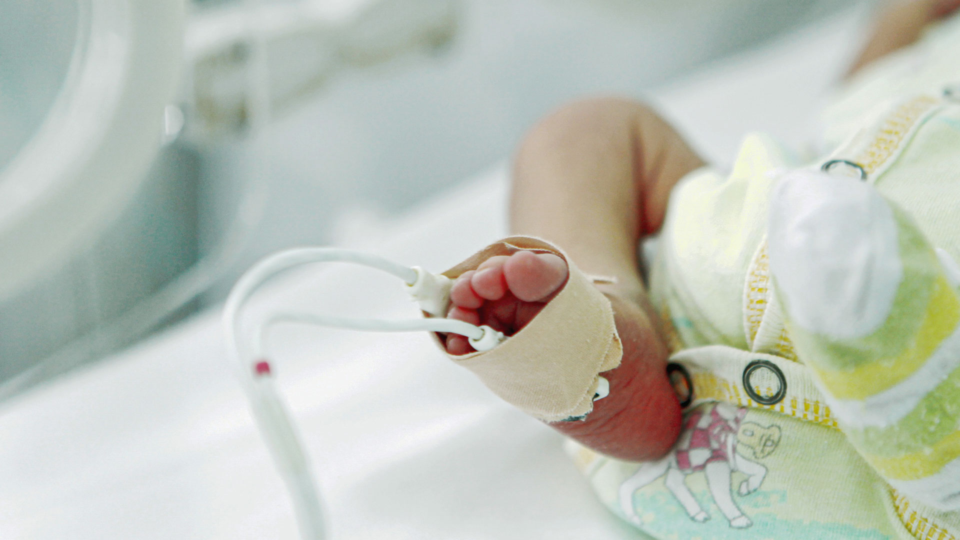 How Caffeine and Acetaminophen Affects Premature Infants' Liver Function