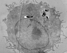 M. tuberculosis in macrophage
